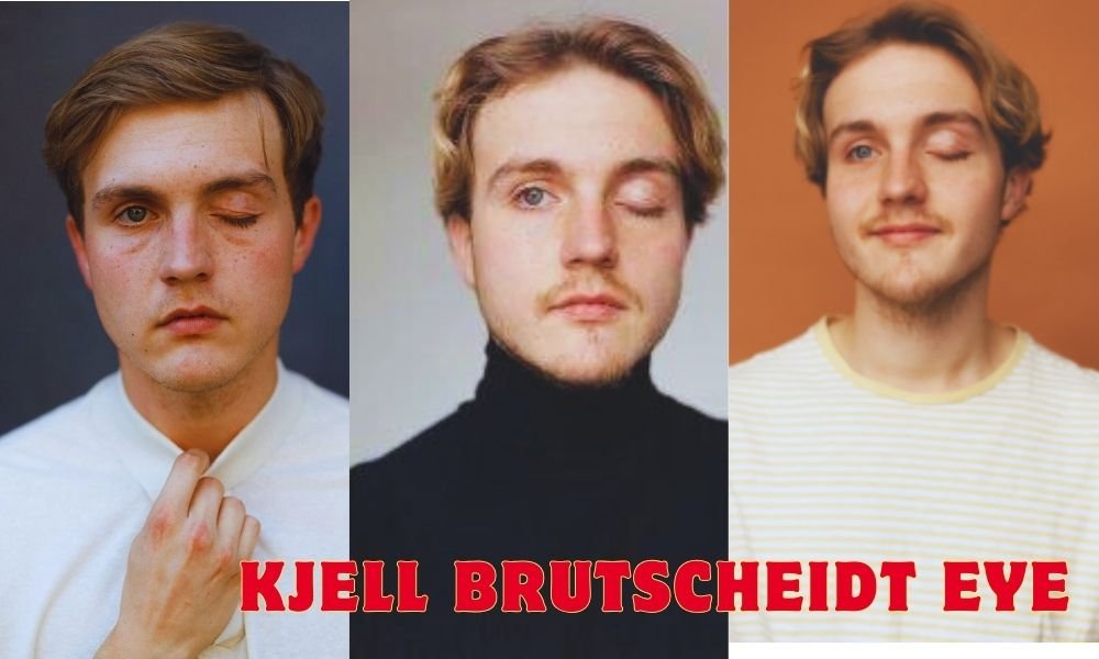 kjell brutscheidt eye